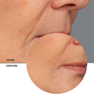 Serum Retinol Antiarrugas Regenerador Unificador