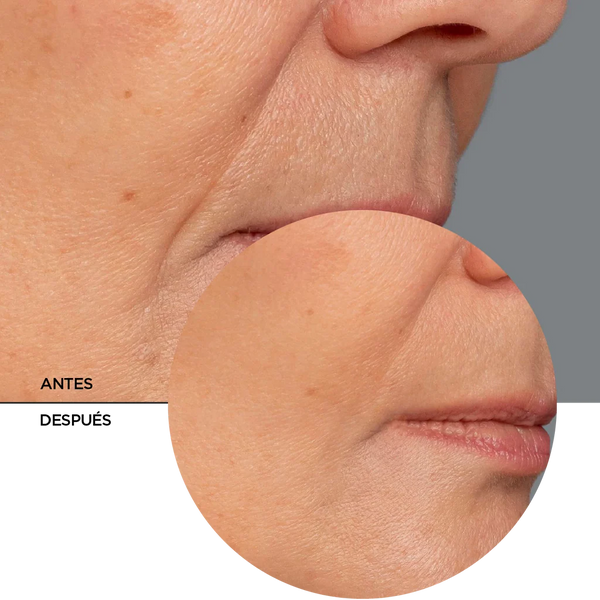 Serum Retinol Antiarrugas Regenerador Unificador