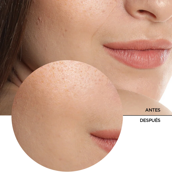 Revox Serum Ácido Hialurónico 5%